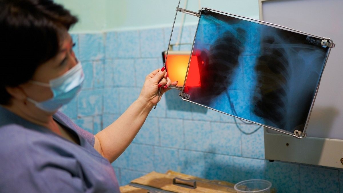 Debt, disaster, and doctors: ADB on financing health in an unpredictable Asia
